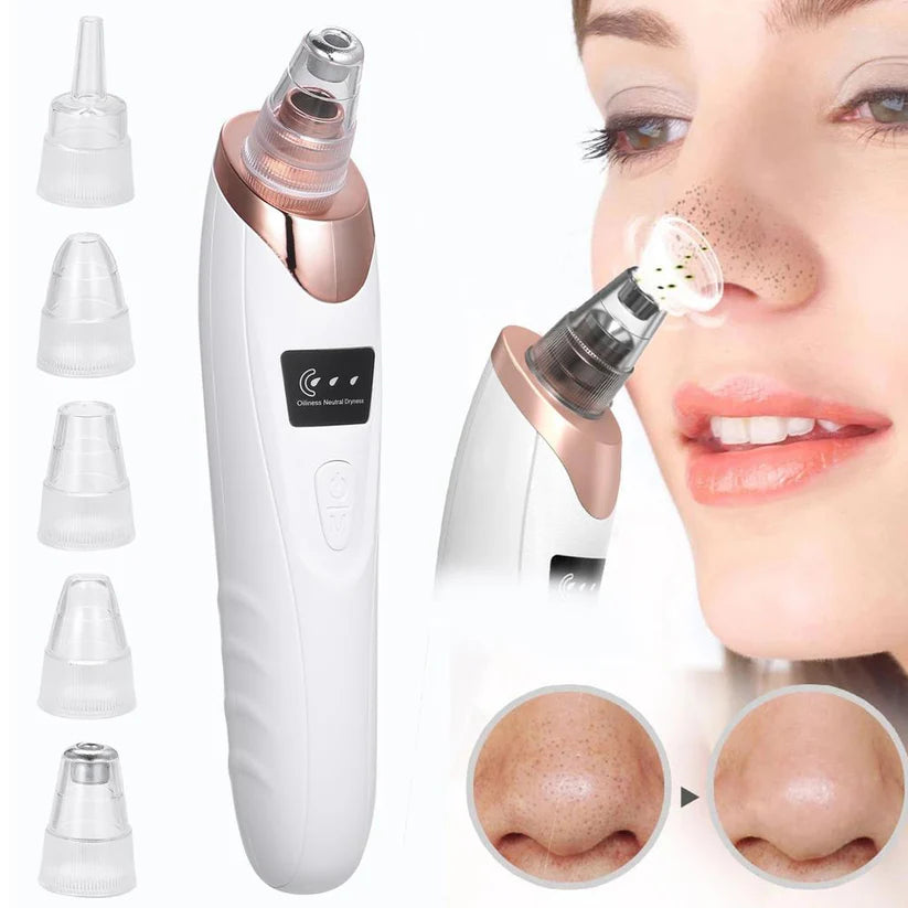 Blackhead Removal Machine – Skin Care & Pore Cleaner